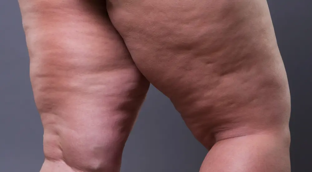 Saúde Vascular